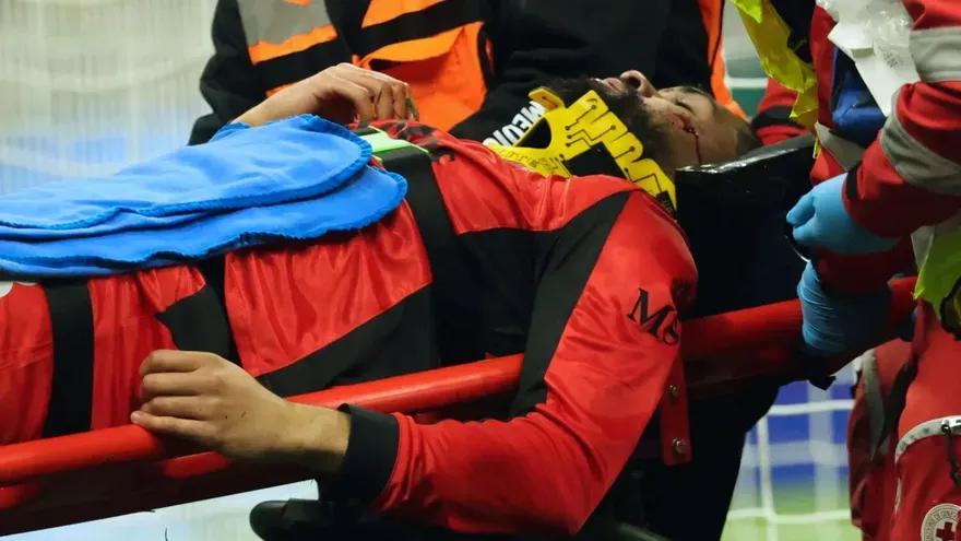 Ruben Loftus-Cheek Injury Update: AC Milan Star Suffers Facial Fracture, Set for Months Out